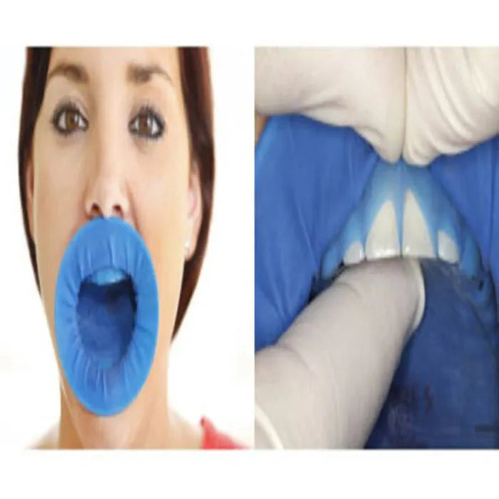 Ivoclar Optradam Plus