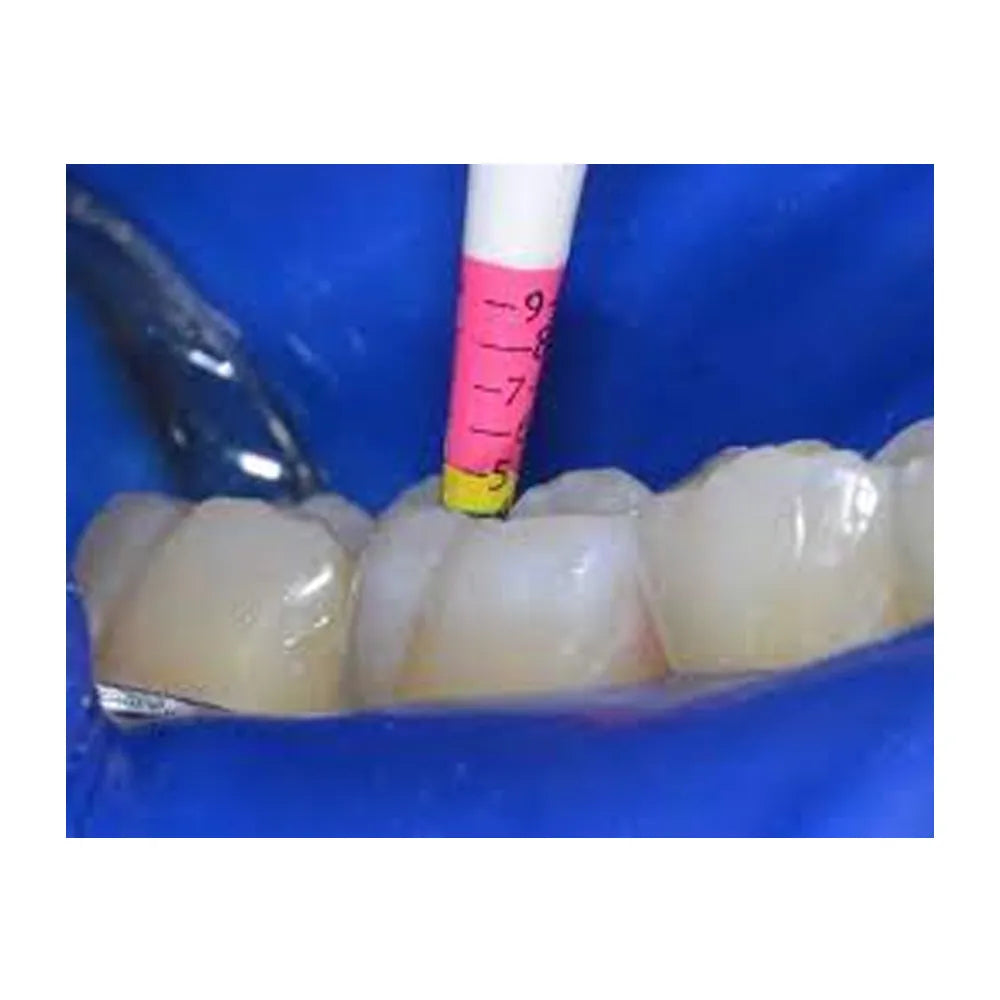 Bioclear Evolve Matrix Height Indicator Probe (500122)