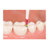 Bioclear Evolve Matrix Height Indicator Probe (500122)