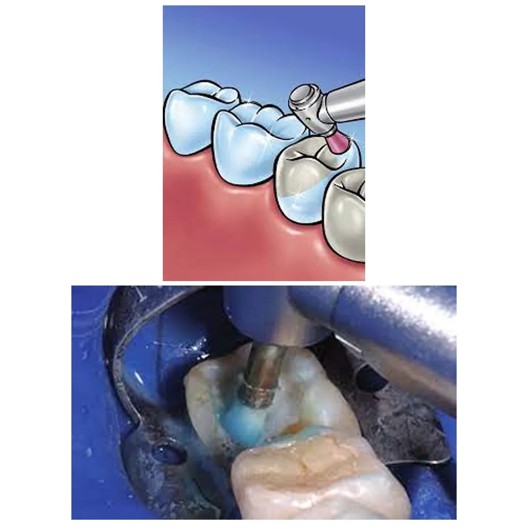 Ivoclar Proxyt Medium Fluoride Free - 80gm (701472)