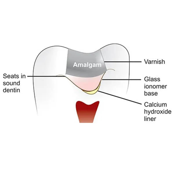 GC Fuji Varnish (5gm)