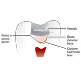 GC Fuji Varnish (5gm)